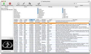 Xphile 放射学资料库-卡核